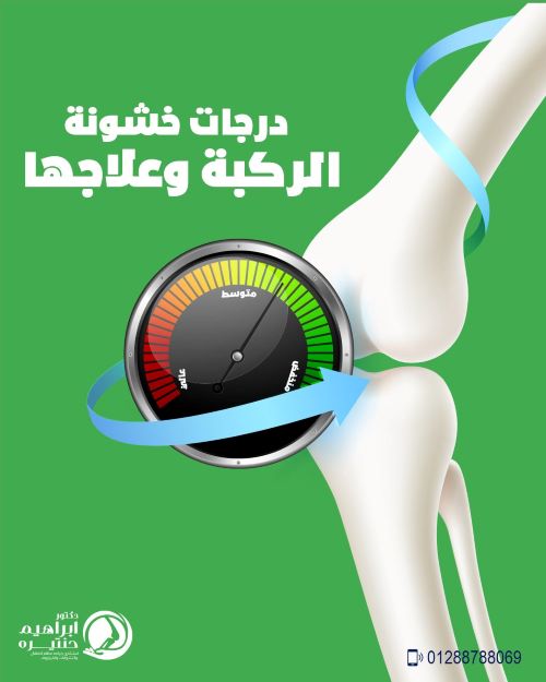 درجات خشونة الركبة